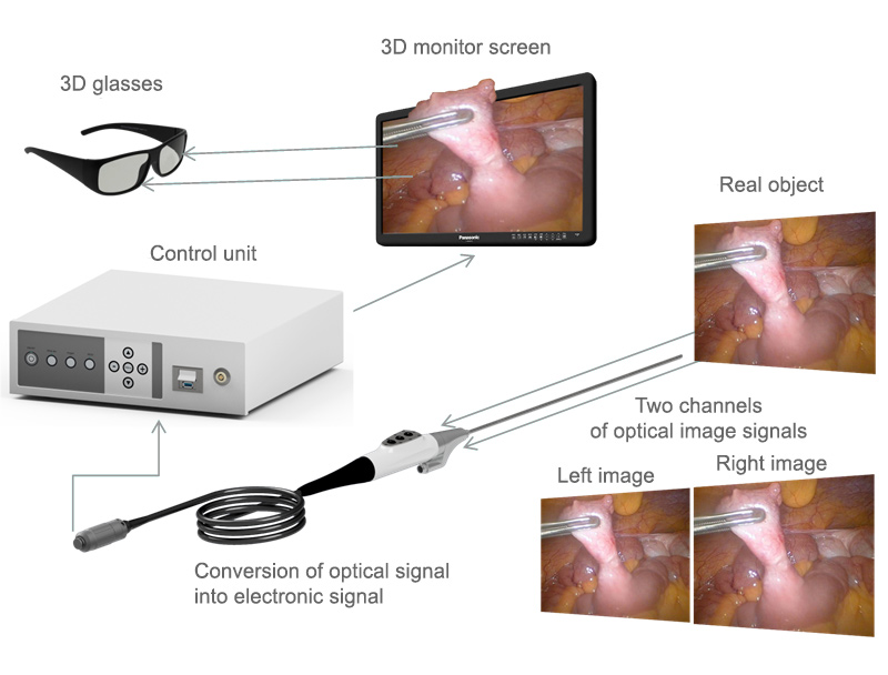 BMTvision 3D Stereoskopie